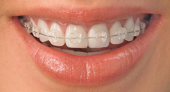 Ortodontia Dentalsul