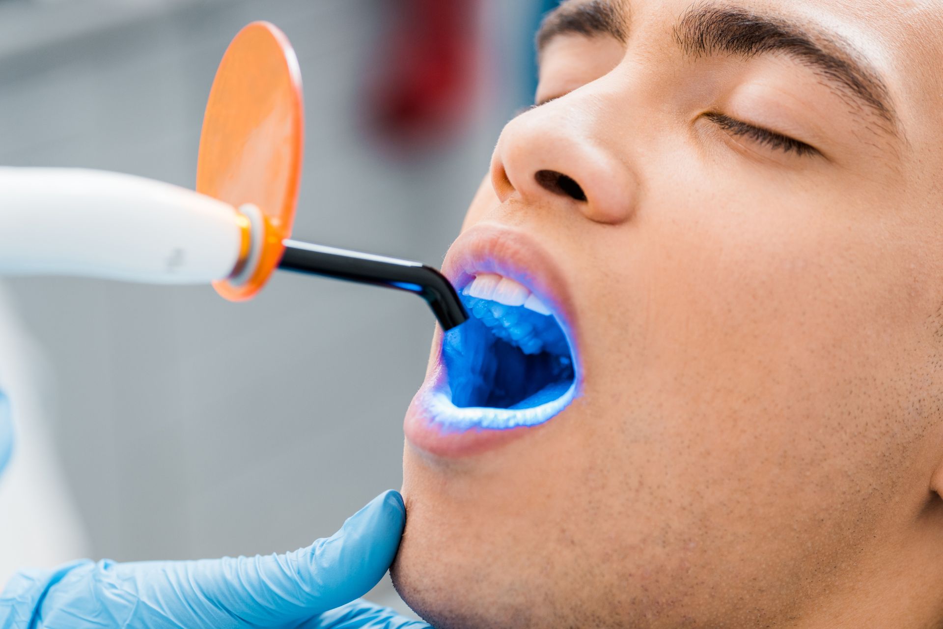 professional teeth whitening at DentalSul Altura